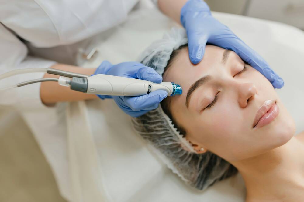 Dermabrasie